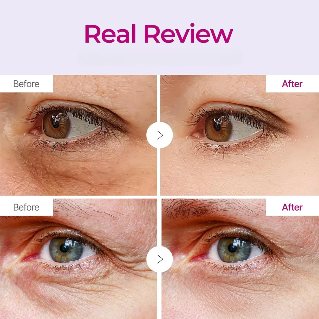 Anti Wrinkle Calcium Eye Patch - Image 3