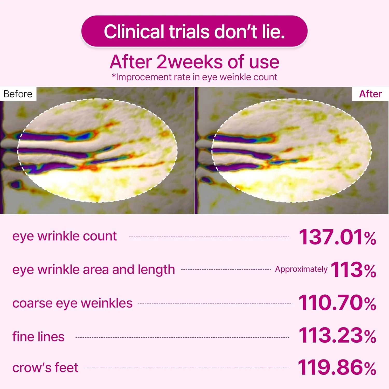 Anti Wrinkle Calcium Eye Patch - Image 6