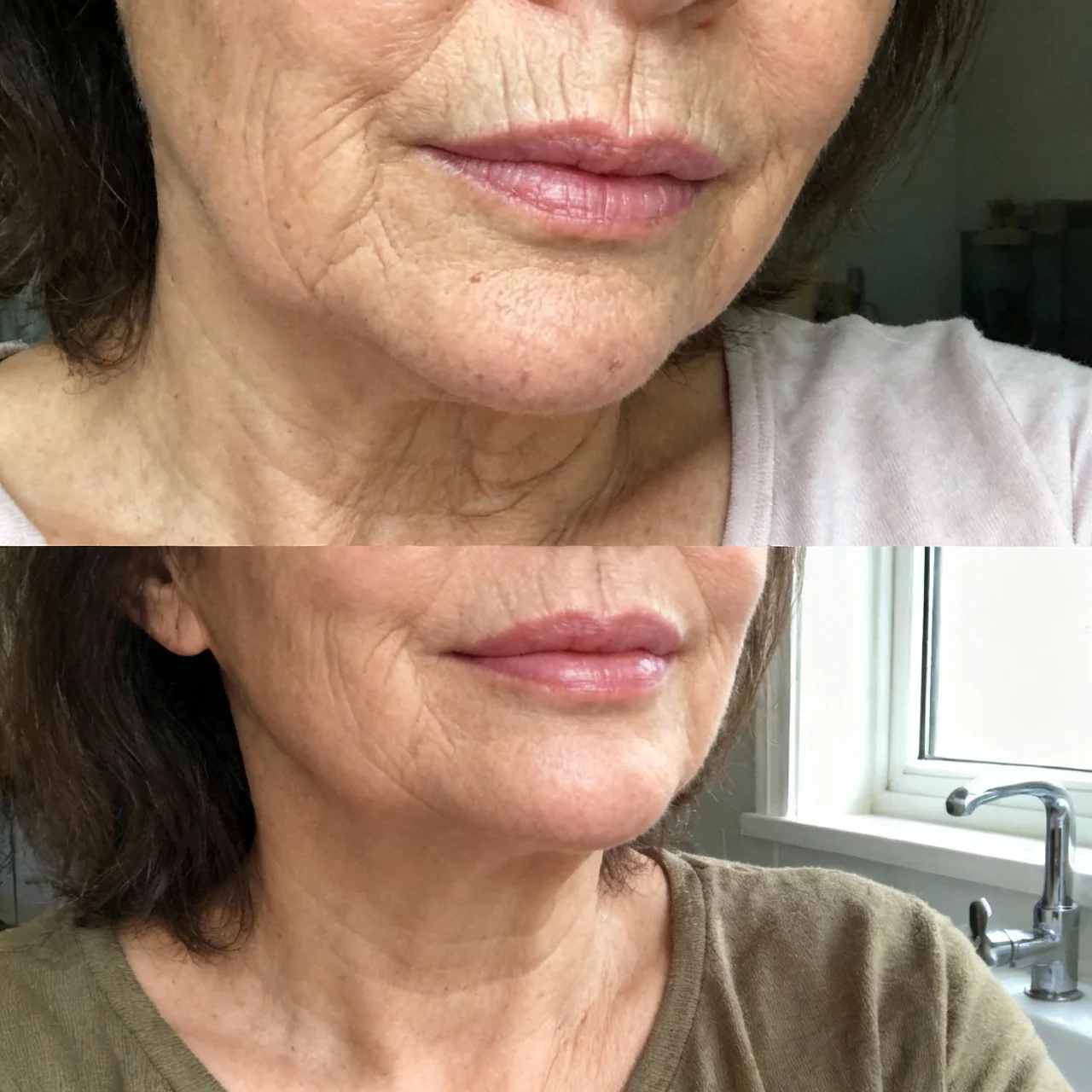 Anti Wrinkle Calcium Balm - Image 3