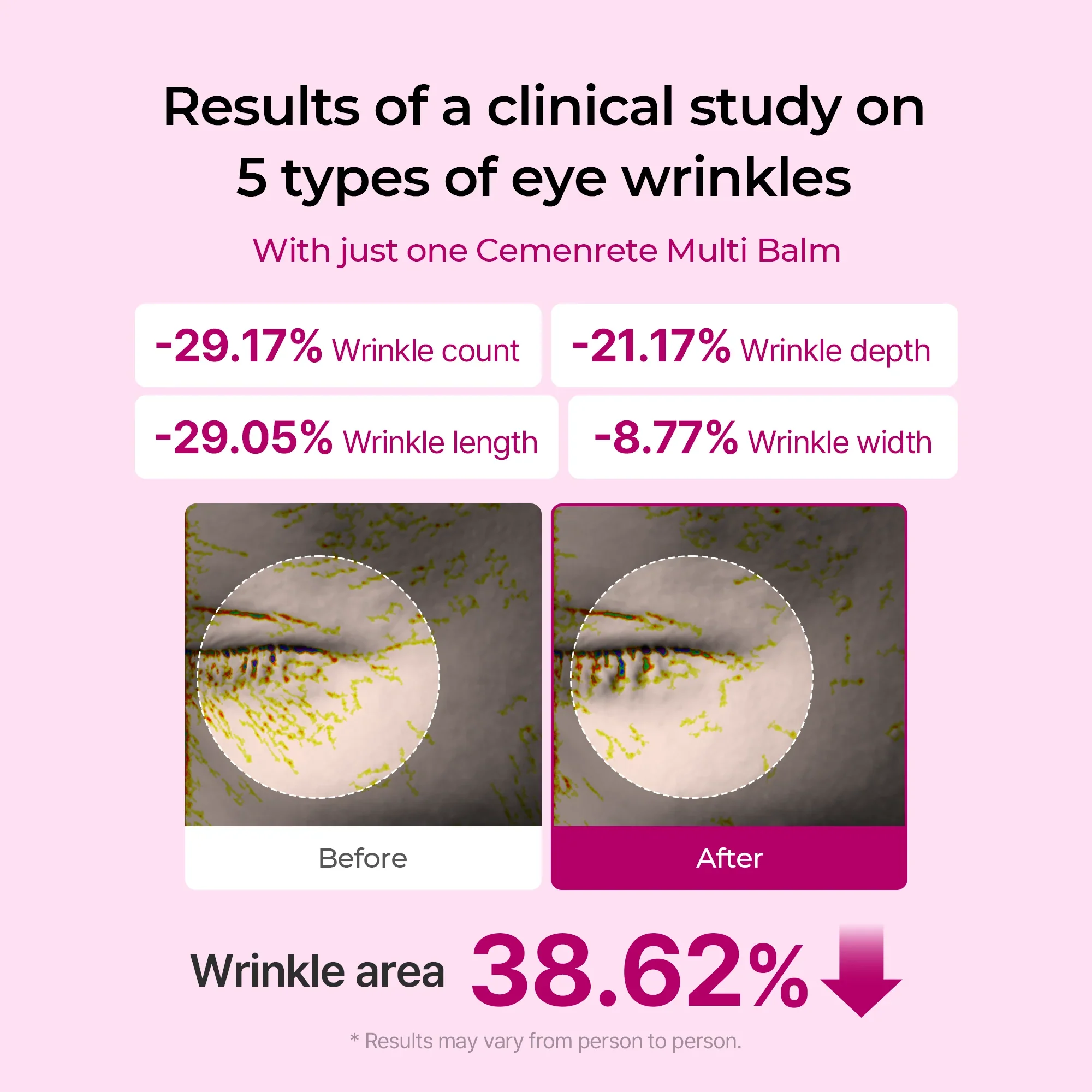 Anti Wrinkle Calcium Balm - Image 6