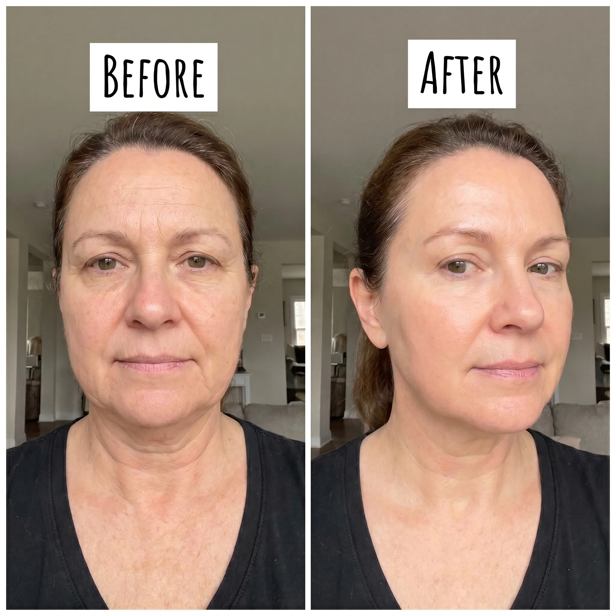 VitaliQ NAD EGF Firming Serum - Image 4